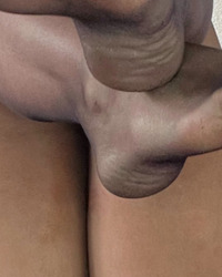 photo-thumb