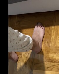 photo-thumb