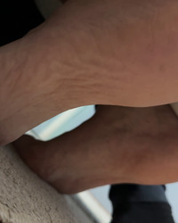 photo-thumb
