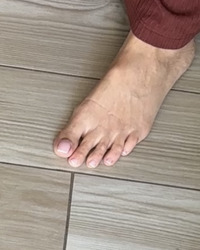 photo-thumb