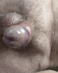 photo-thumb