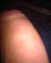 photo-thumb