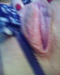 photo-thumb