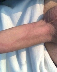 photo-thumb