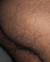 photo-thumb