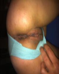 photo-thumb
