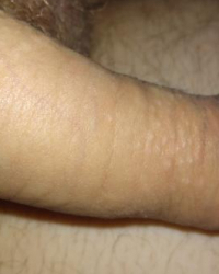 photo-thumb