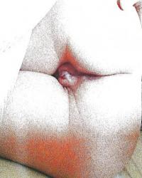 photo-thumb
