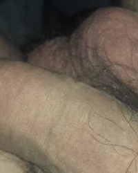 photo-thumb