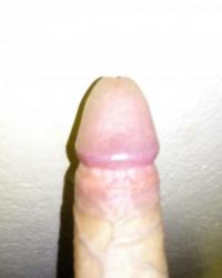 photo-thumb