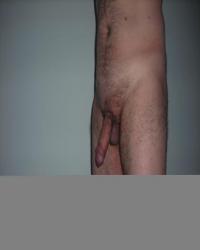 photo-thumb
