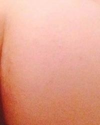 photo-thumb