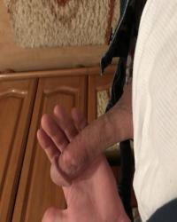photo-thumb