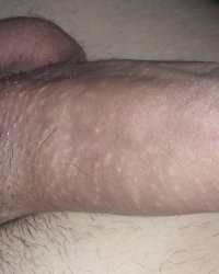 photo-thumb