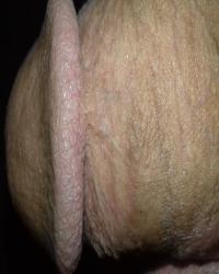 photo-thumb