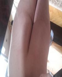 photo-thumb
