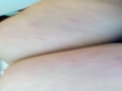 Thumb 11