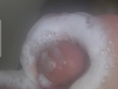 Thumb 6
