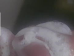Thumb 9